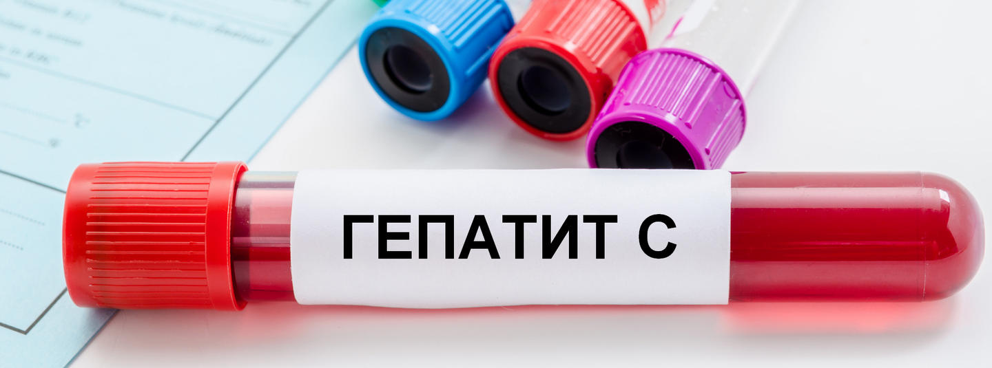 Скільки живуть з гепатитом С: що впливає на тривалість життя та як змінюється прогноз після лікування